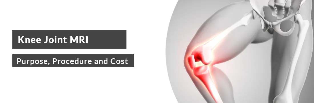Knee Joint MRI: Purpose, Procedure, Cost and Best MRI Centre